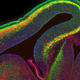 Illustration for article titled What a Mouse Brain Looks Like When It Rewires Itself